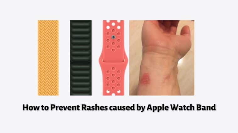 How to Prevent Rashes caused by Apple Watch Band